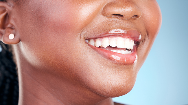 Treatment - Platinum Orthodontics dental